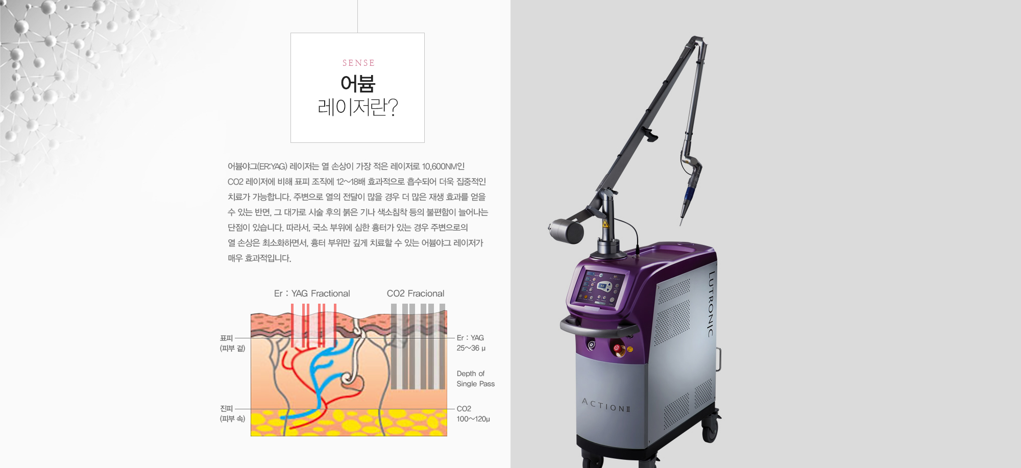 어븀 레이저란? 어븀야그(Er:YAG) 레이저는 열 손상이 가장 적은 레이저로 10,600nm인 CO2 레이저에 비해 표피 조직에 12~18배 효과적으로 흡수되어 더욱 집중적인 치료가 가능합니다. 주변으로 열의 전달이 많을 경우 더 많은 재생 효과를 얻을 수 있는 반면, 그 대가로 시술 후의 붉은 기나 색소침착 등의 불편함이 늘어나는 단점이 있습니다. 따라서, 국소 부위에 심한 흉터가 있는 경우 주변으로의 열 손상은 최소화하면서, 흉터 부위만 깊게 치료할 수 있는 어븀야그 레이저가 매우 효과적입니다.