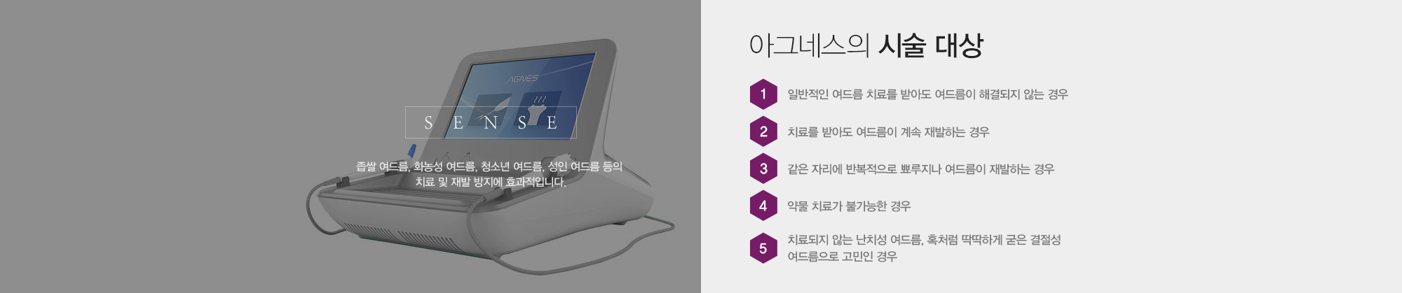 아그네스의 시술 대상 1)일반적인 여드름 치료를 받아도 여드름이 해결되지 않는 경우 2)치료를 받아도 여드름이 계속 재발하는 경우 3)같은 자리에 반복적으로 뾰루지나 여드름이 재발하는 경우 4)약물 치료가 불가능한 경우 5)치료되지 않는 난치성 여드름, 혹처럼 딱딱하게 굳은 결절성 여드름으로 고민인 경우