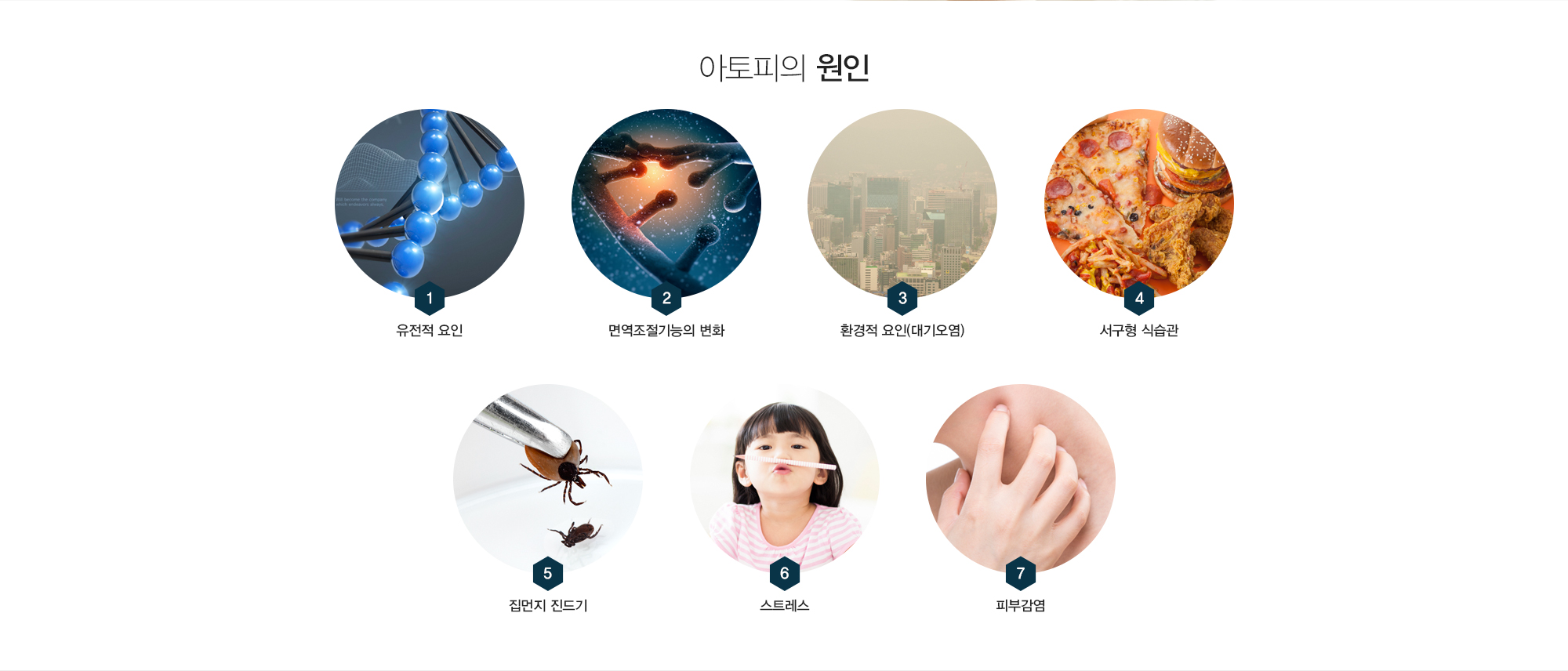 아토피의 원인:1)유전적 요인2)면역조절기능의 변화3)환경적 요인(대기오염)4)서구형 식습관5)집먼지 진드기6)스트레스7)피부감염