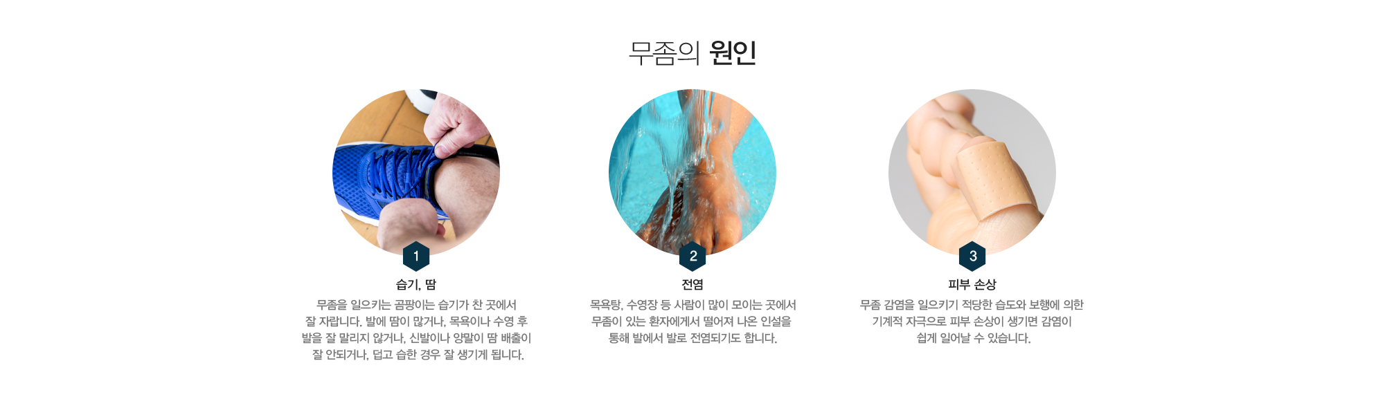 무좀의 원인:1)습기,땀-무좀을 일으키는 곰팡이는 습기가 찬 곳에서 잘 자랍니다. 발에 땀이 많거나, 목욕이나 수영 후 발을 잘 말리지 않거나, 신발이나 양말이 땀 배출이 잘 안되거나, 덥고 습한 경우 잘 생기게 됩니다. 2)전염-목욕탕, 수영장 등 사람이 많이 모이는 곳에서 무좀이 있는 환자에게서 떨어져 나온 인설을 통해 발에서 발로 전염되기도 합니다. 3)피부손상-무좀 감염을 일으키기 적당한 습도와 보행에 의한 기계적 자극으로 피부 손상이 생기면 감염이 쉽게 일어날 수 있습니다.