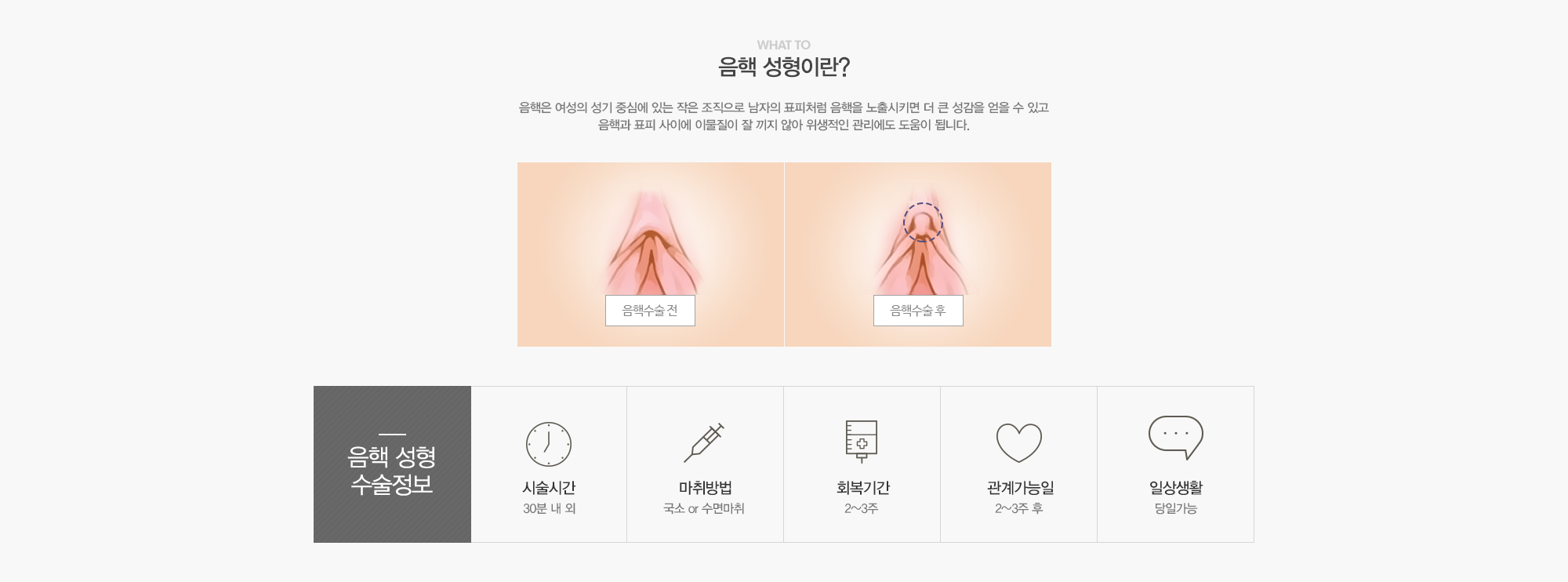 음핵성형이란?음핵은 여성의 성기 중심에 있는 작은 조직으로 남자의 표피처럼 음핵을 노출시키면 더 큰 성감을 얻을 수 있고 음핵과 표피 사이에 이물질이 잘 끼지 않아 위생적인 관리에도 도움이 됩니다.//음핵성형수술정보:시술시간30분내외,국소or수면마취,회복기간2-3주,관계가능일2-3주후,일상생활당일가능